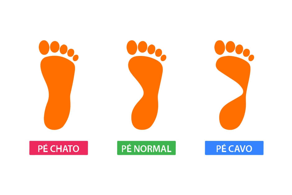 tipos de pés (normal, cavo ou plano)?